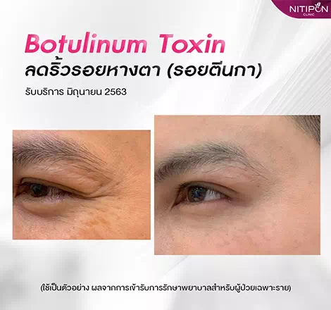 Beautytobook | Nitipon Clinic (ฟรายเดย์ อุตรดิตถ์)
